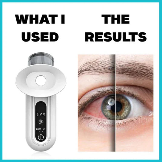 EyeMist™ Pro – Sonic Nano Eye Steamer with Moist Heat Therapy & Dual Spray Modes